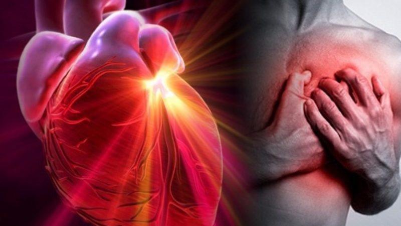 Болезни сердечно-сосудистой системы | Информационный портал Кардио Канон (1)