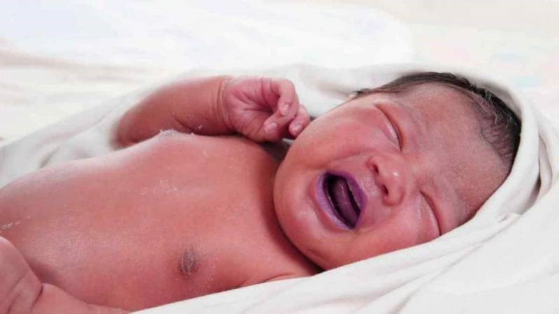 Что такое легочная гипертензия новорожденных | Информационный портал Кардио Канон (4)